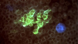 Herpes virus triggers mood disorders through neurological impact